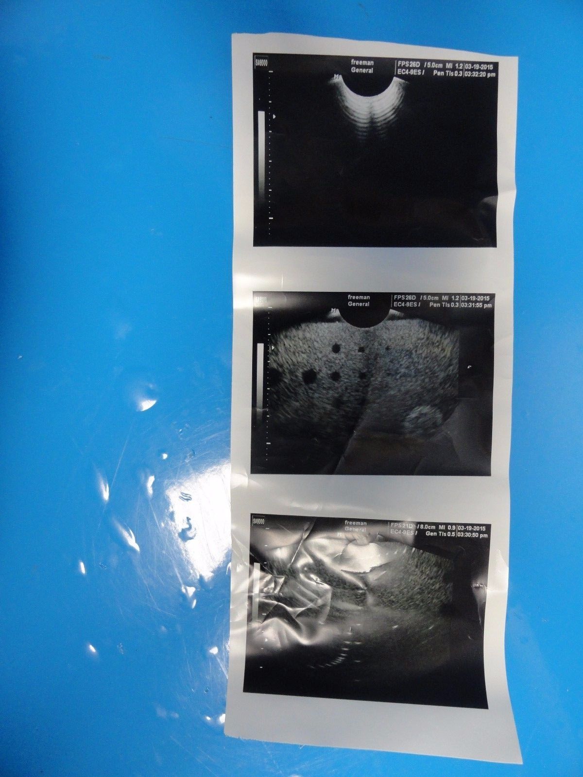 SAMSUNG MEDISON EC4-9ES ENDOCAVITY Ultrasound Transducer Probe (11802) DIAGNOSTIC ULTRASOUND MACHINES FOR SALE