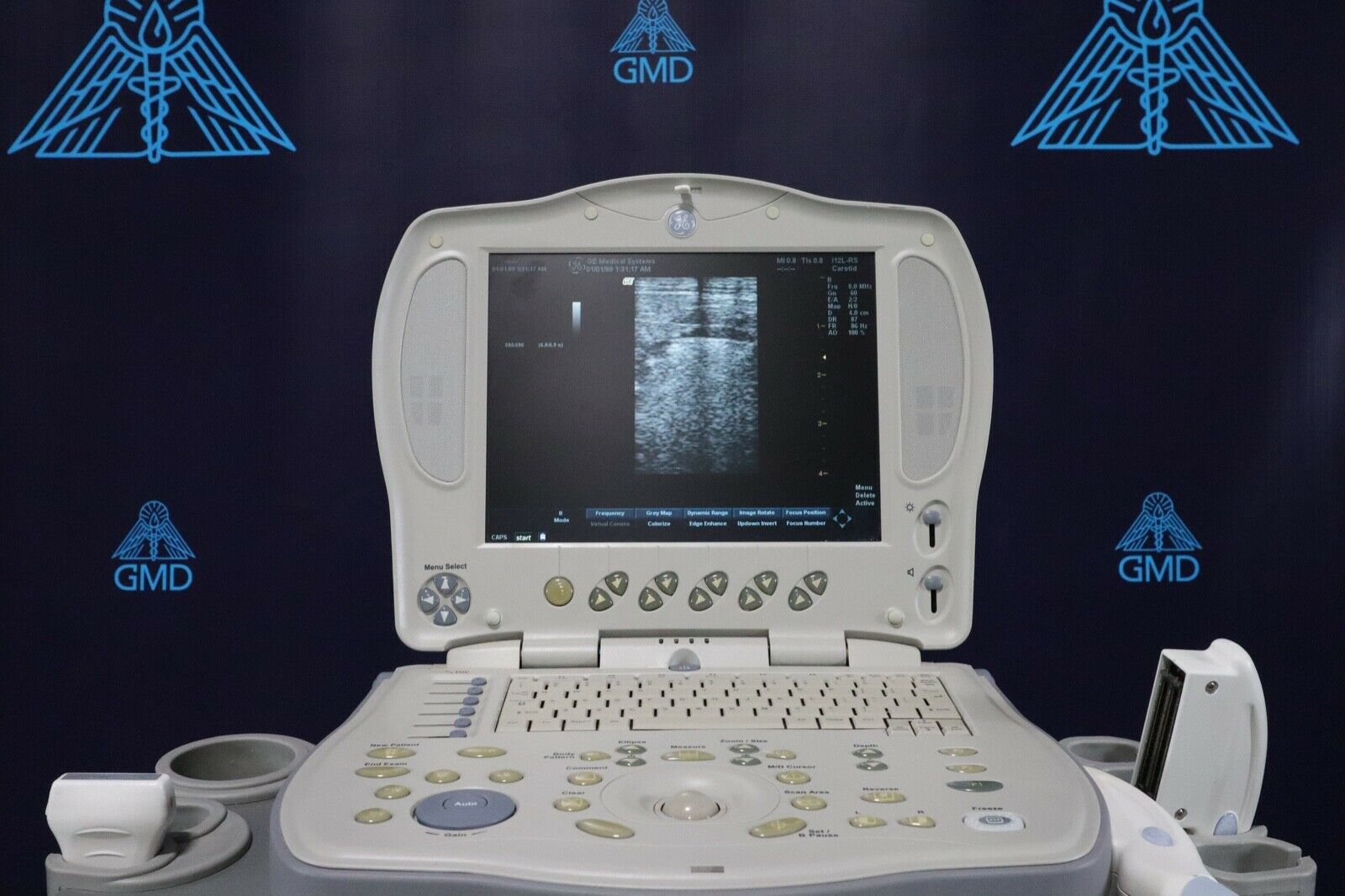 GE LOGIQ BOOK XP PORTABLE ULTRASOUND DIAGNOSTIC ULTRASOUND MACHINES FOR SALE
