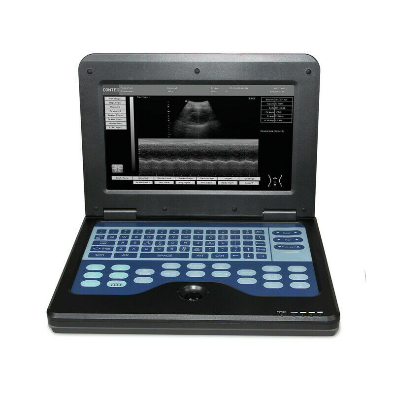 Digital Portable Ultrasound Machine Laptop Scanner with Convex Probe,US shipping 6945040100362 DIAGNOSTIC ULTRASOUND MACHINES FOR SALE