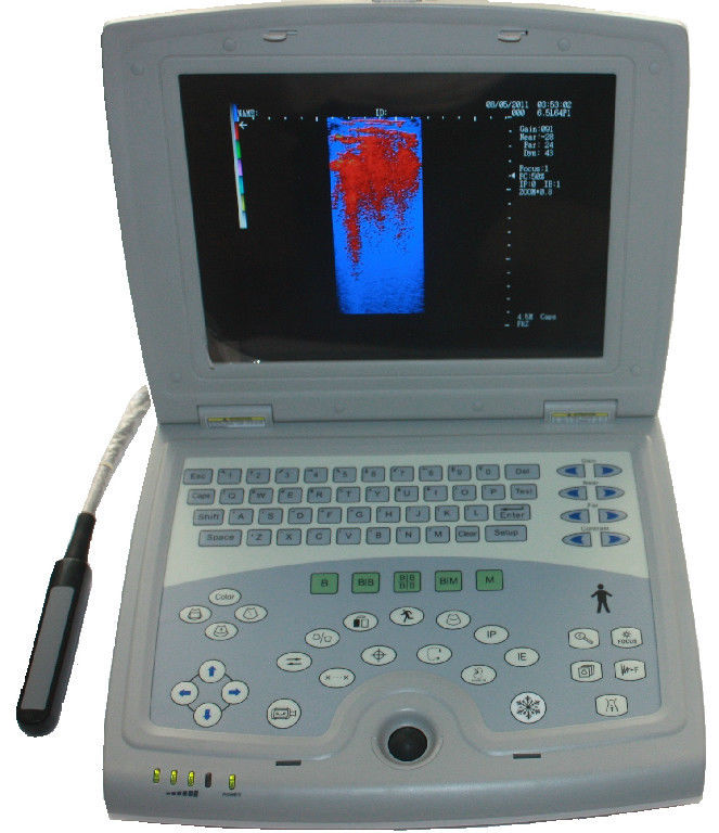 Veterinary Laptop Ultrasound Scanner 10" LCD & Rectal Probe - USA Warranty Deal DIAGNOSTIC ULTRASOUND MACHINES FOR SALE