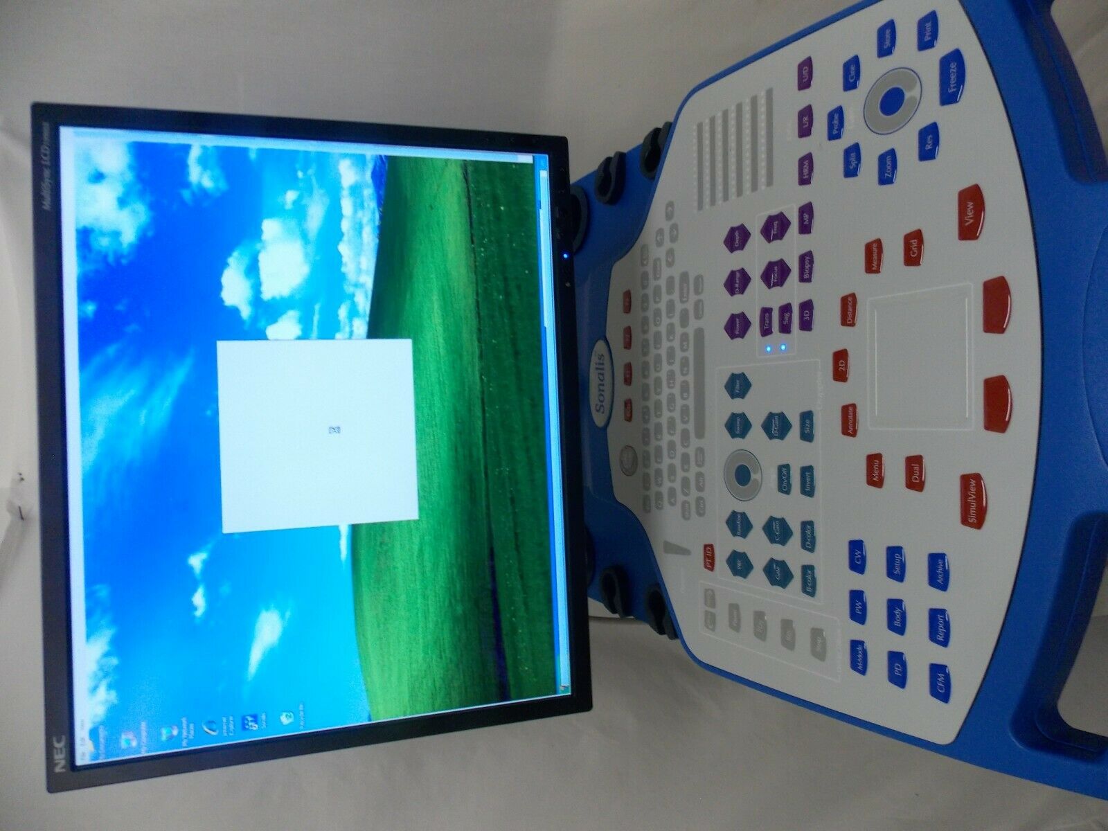 NOMOS P/N 206,326 SONALIS Ultrasound Imaging System DIAGNOSTIC ULTRASOUND MACHINES FOR SALE