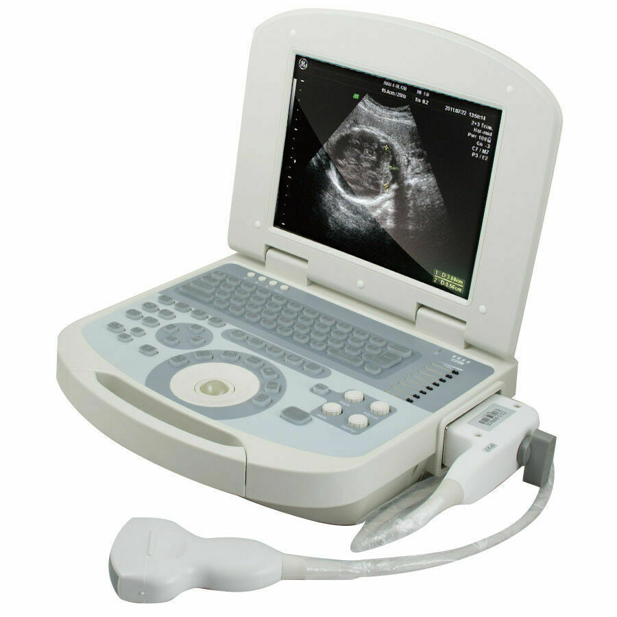 Portable Medical Digital Laptop Ultrasound Scanner Machine 3.5 Convex probe+3D DIAGNOSTIC ULTRASOUND MACHINES FOR SALE