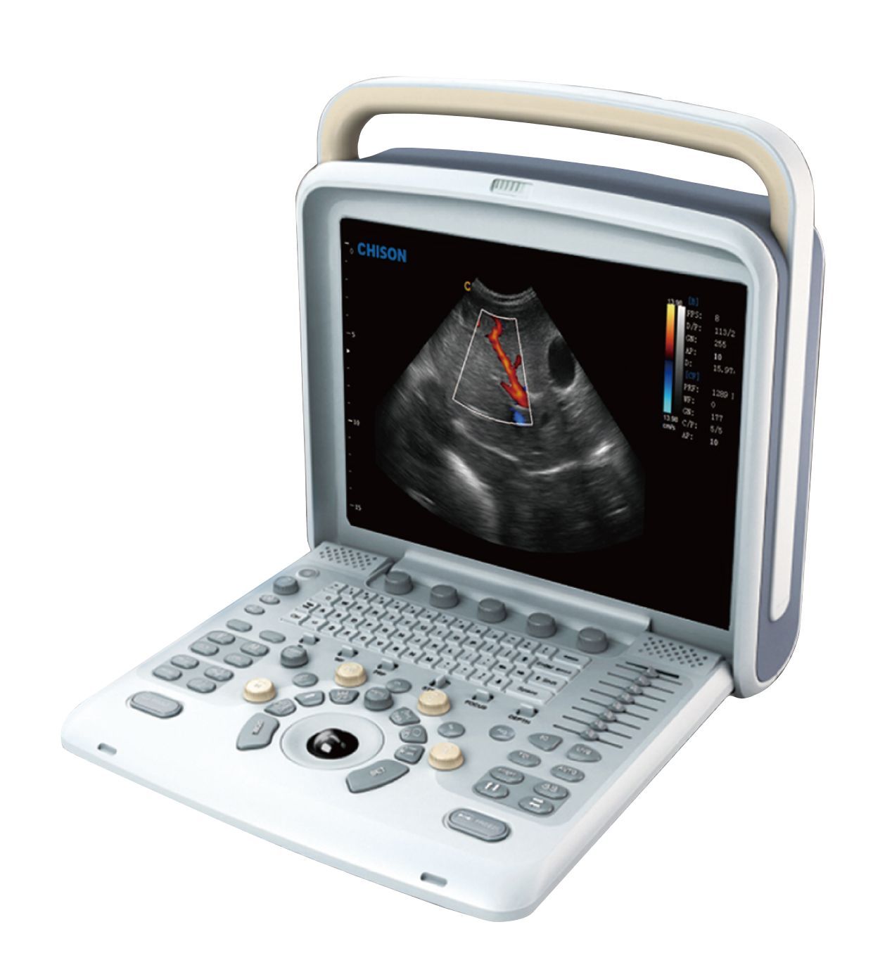 Veterinary Ultrasound Scanner with Two probes - Color Doppler Chison Q5Vet DIAGNOSTIC ULTRASOUND MACHINES FOR SALE