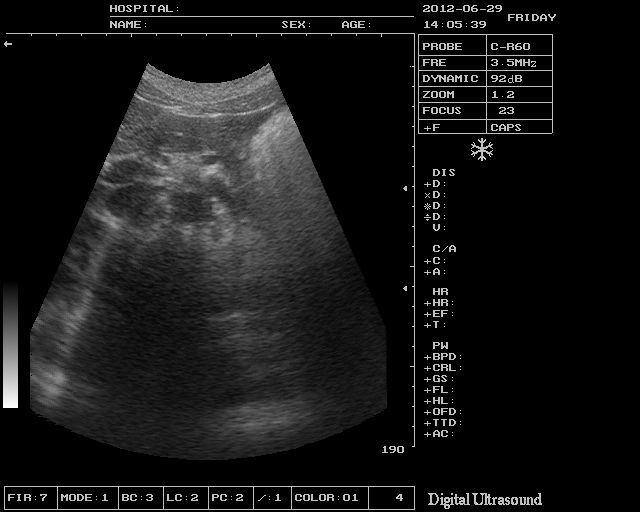 Portable Veterinary Ultrasound Scanner Machine Linear Probe 3D Veterinarian DIAGNOSTIC ULTRASOUND MACHINES FOR SALE