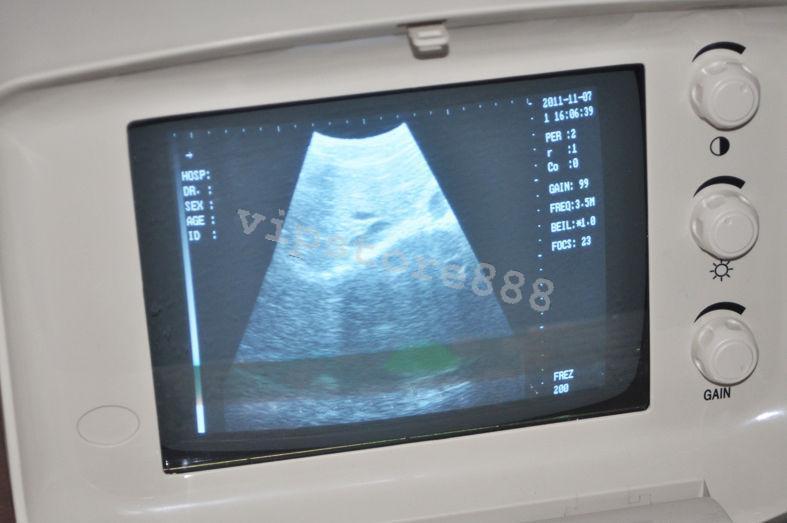 Convex Probe &Transvaginal Probe Digital Portable Ultrasound Scanner 3D Portable DIAGNOSTIC ULTRASOUND MACHINES FOR SALE