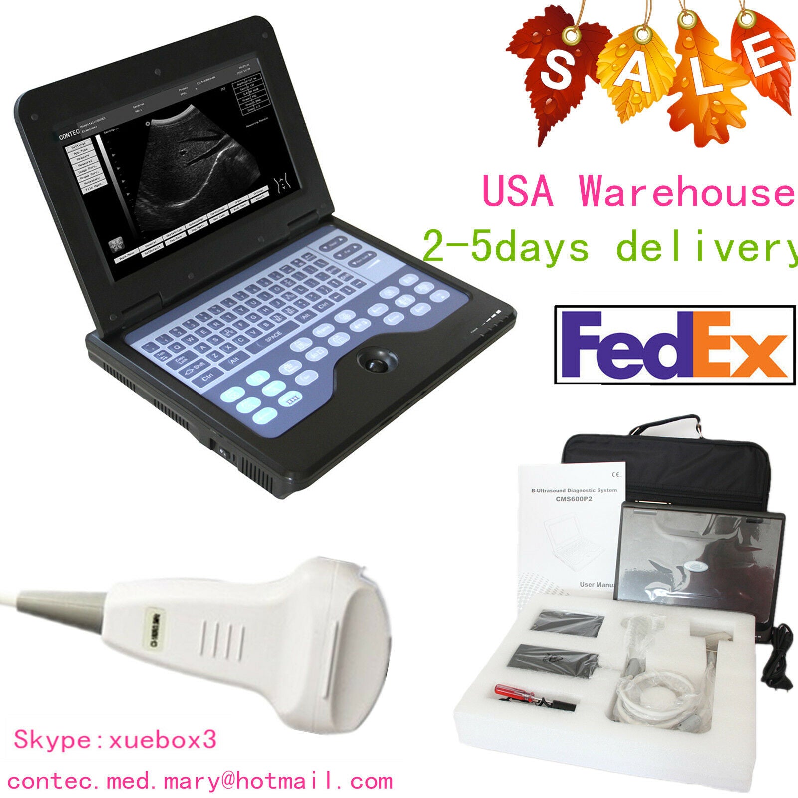 Portable laptop machine, Digital Ultrasound scanner, 3.5M Convex probe,US FedEx  658126883672 DIAGNOSTIC ULTRASOUND MACHINES FOR SALE