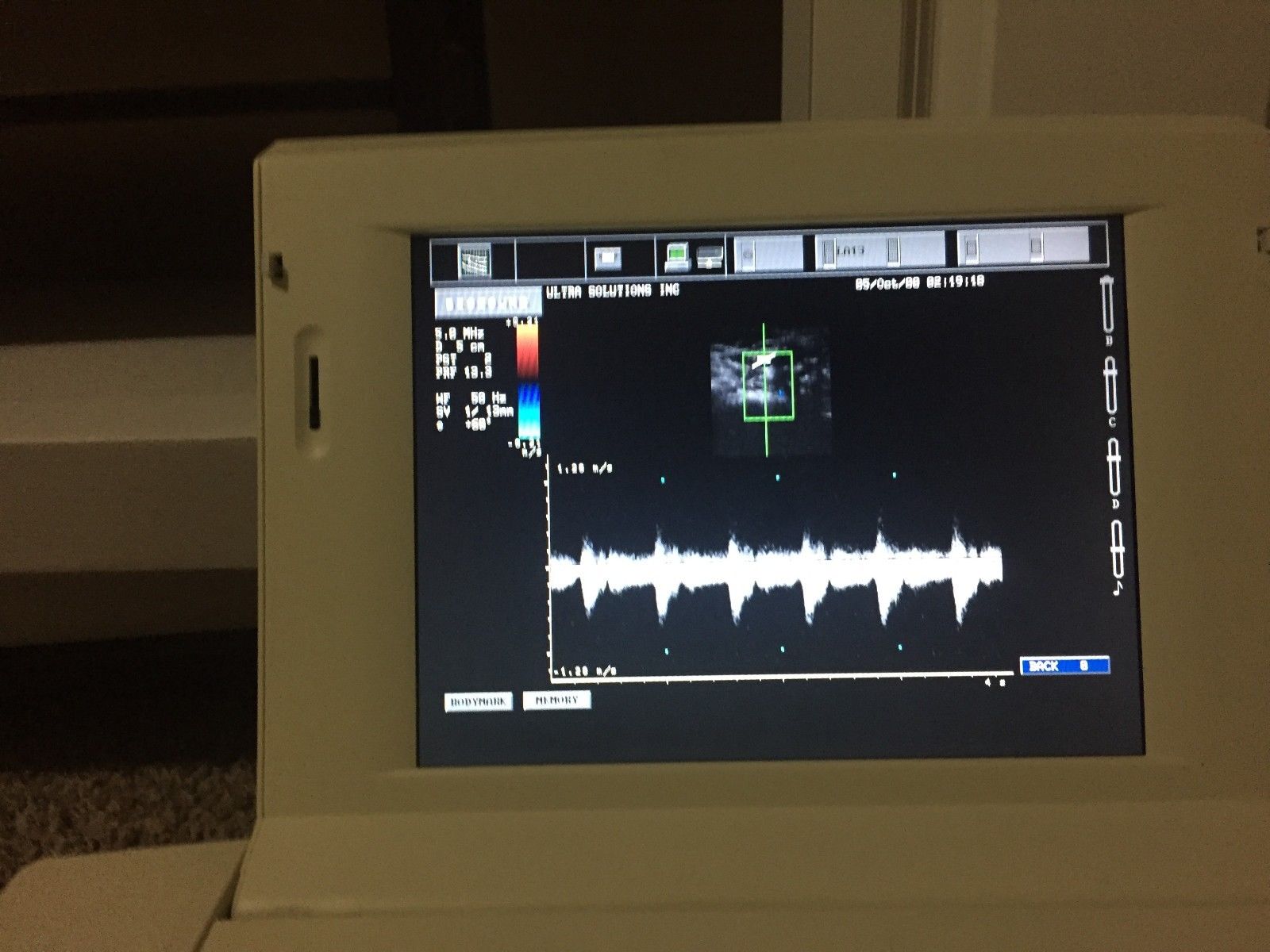 Esaote Biosound AU3, AU4, AU5 ultrasound linear probe LA13 DIAGNOSTIC ULTRASOUND MACHINES FOR SALE