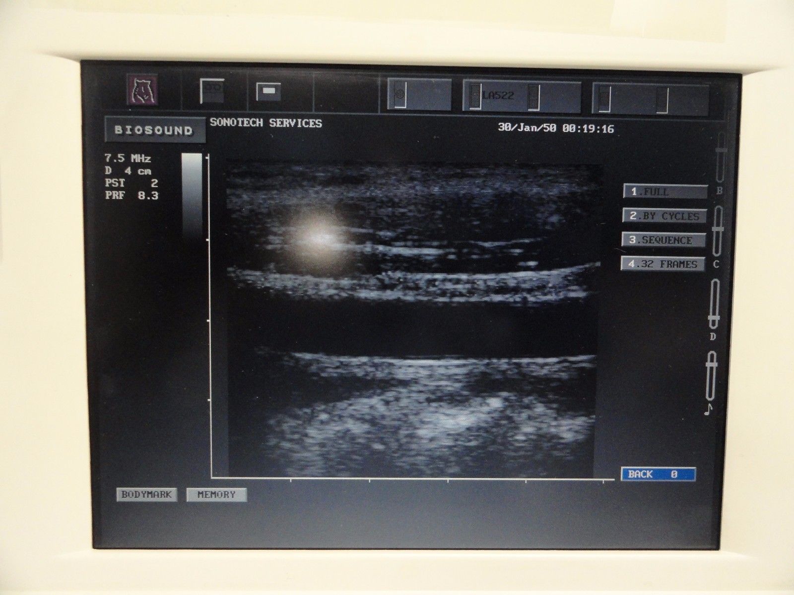 Biosound ESAOTE LA522E Linear Array Ultrasound Transducer for MyLab Series~13596 DIAGNOSTIC ULTRASOUND MACHINES FOR SALE