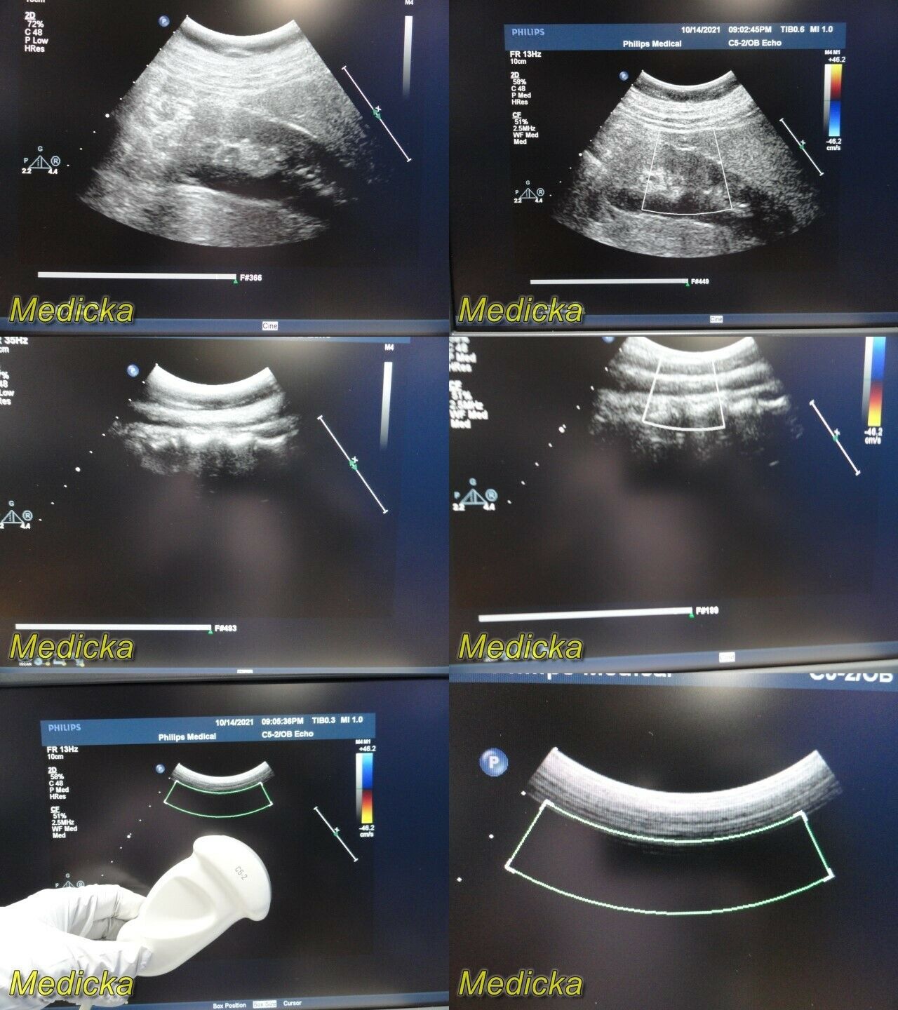 Philips C5-2 Convex Array Ultrasound Transducer Probe *TESTED & WORKING* ~ 26342 DIAGNOSTIC ULTRASOUND MACHINES FOR SALE