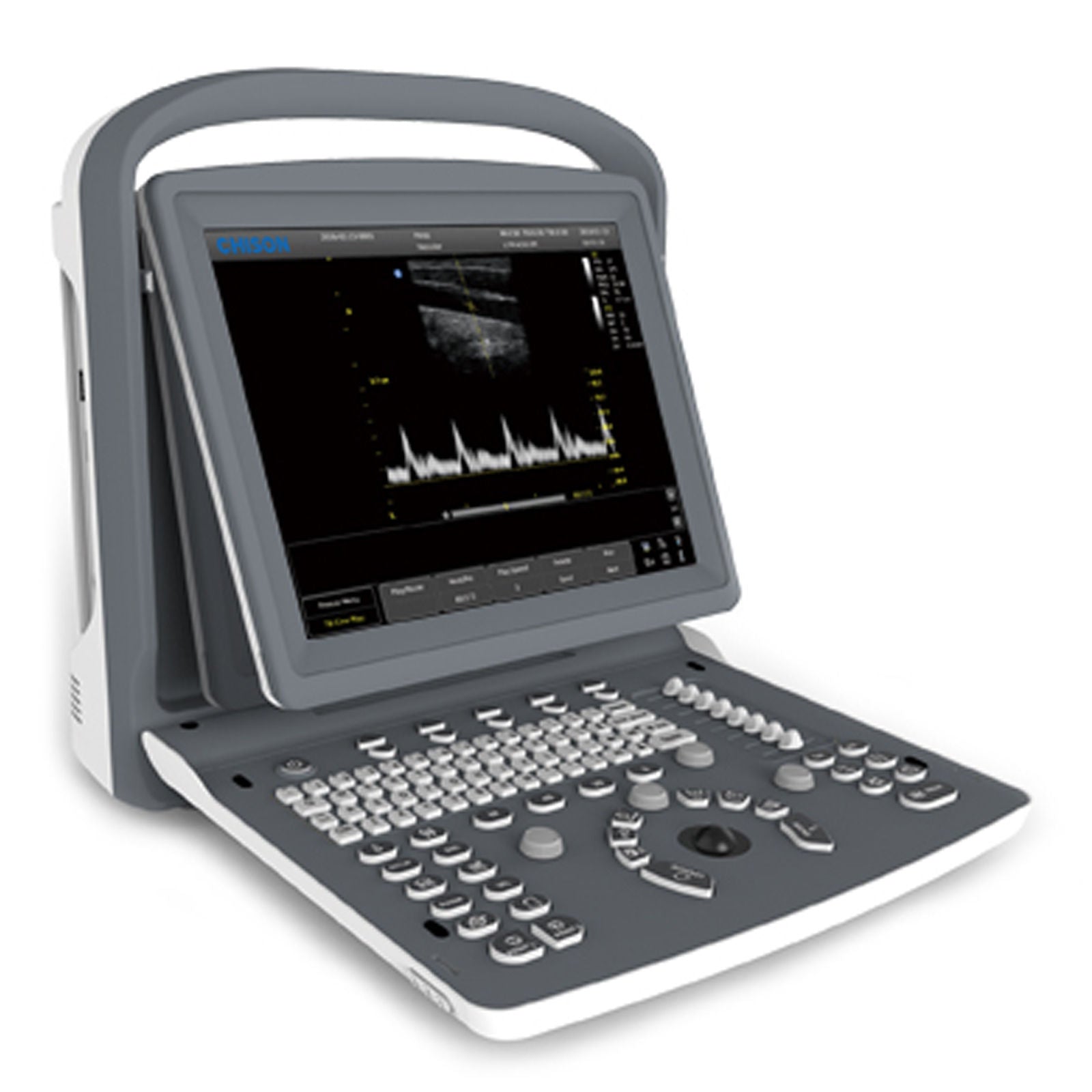 ECO2 Chison Portable Digital Ultrasound Scanner+3.5MHz ConvexProbe+CASE all d DIAGNOSTIC ULTRASOUND MACHINES FOR SALE