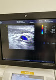 GE 9L-D  Ultrasound Probe / Transducer