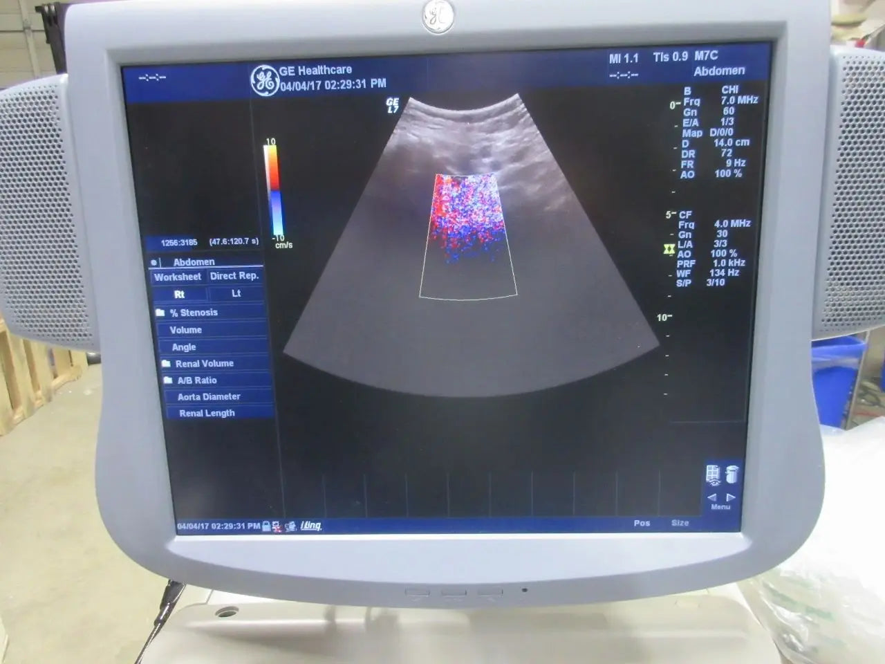 GE Logiq 7  ultrasound LCD with M12L  linear, M7C convex and E8C endovag. DIAGNOSTIC ULTRASOUND MACHINES FOR SALE