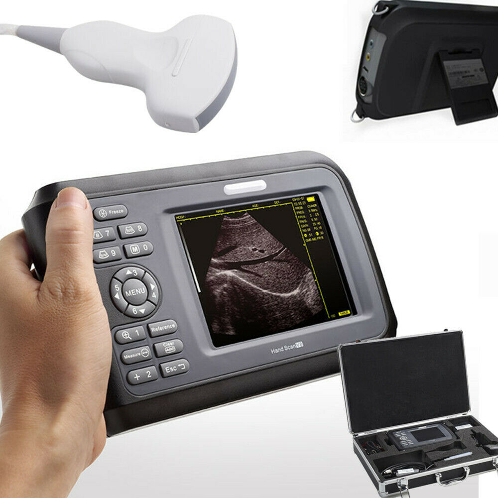 Handheld Portable Ultrasound Machine Scanner Convex Porbe/Sensor For Human Use DIAGNOSTIC ULTRASOUND MACHINES FOR SALE