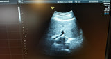 GE4C-D Ultrasound Probe/Transducer
