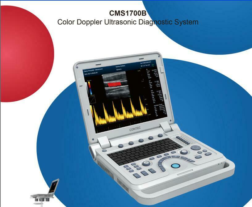 Laptop Color Doppler Ultrasound Scanner Power Doppler Diagnostic Machine System DIAGNOSTIC ULTRASOUND MACHINES FOR SALE