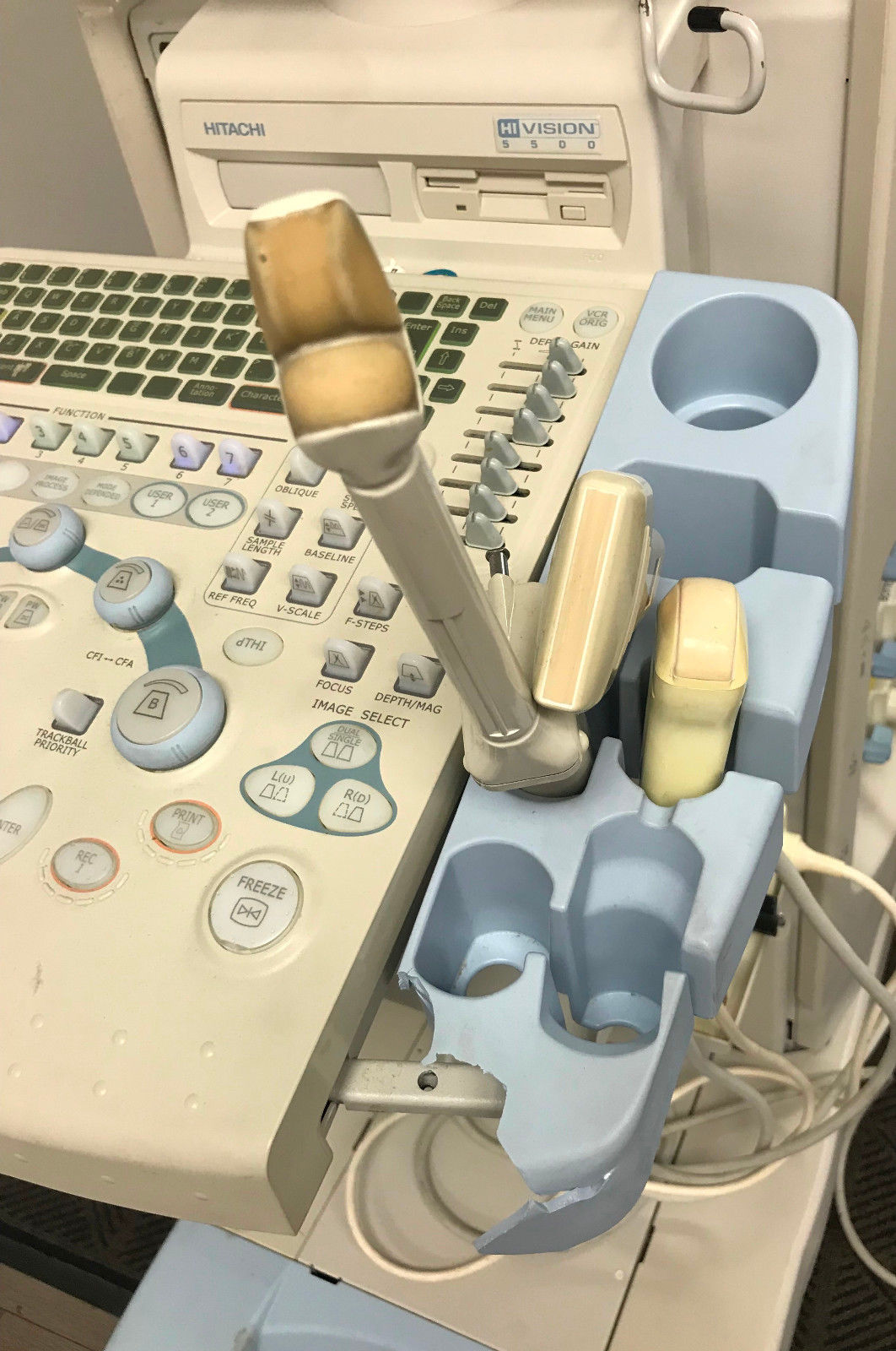 Hitachi HI Vision 5500 Ultrasound Diagnostic Scanner EUB-5500 w/ 3 Transducers DIAGNOSTIC ULTRASOUND MACHINES FOR SALE