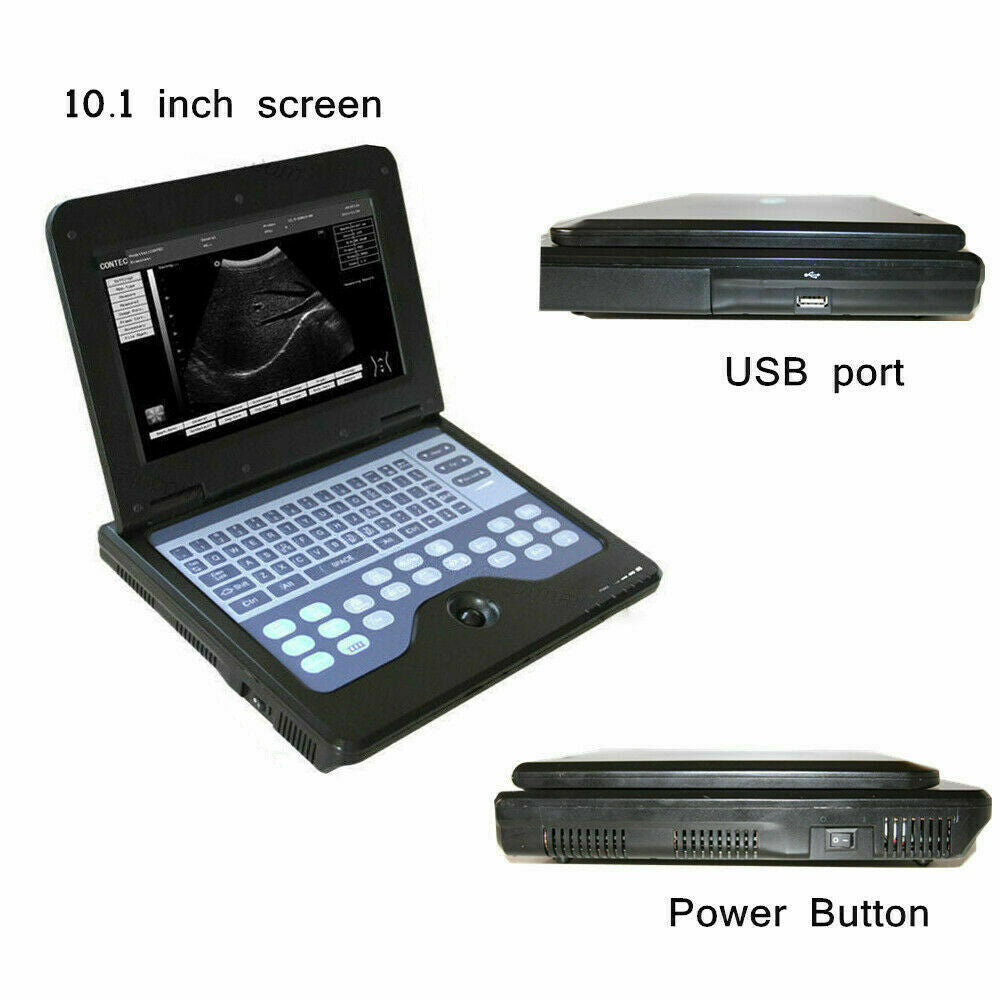 Digital Portable Ultrasound Machine Laptop Scanner with 2 Probes(Convex+Rectal） DIAGNOSTIC ULTRASOUND MACHINES FOR SALE