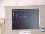 Medison SonoVet 2000 Veterinary Small Animal Digital Ultrasound