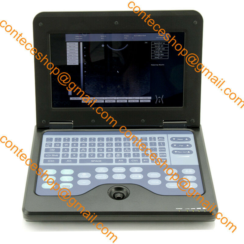 VET Ultrasound Scanner Portable Laptop Machine Rectal+Micro-convex 2 Probes USA 658126883672 DIAGNOSTIC ULTRASOUND MACHINES FOR SALE