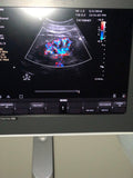 PHILIPS CLEARVUE 550 ULTRASOUND SYSTEM L12-4, C5-2, C9-4 V PROBES
