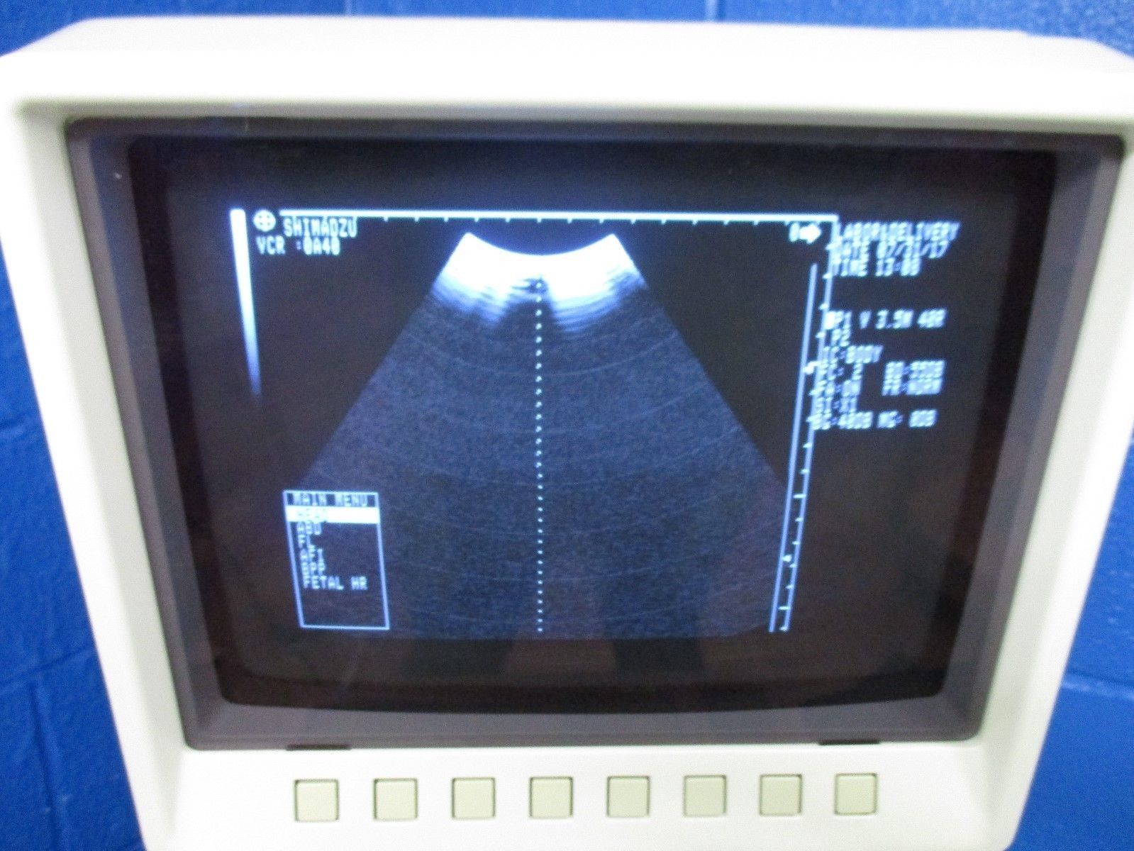 Shimadzu SDU-400 Plus A Ultrasound DIAGNOSTIC ULTRASOUND MACHINES FOR SALE