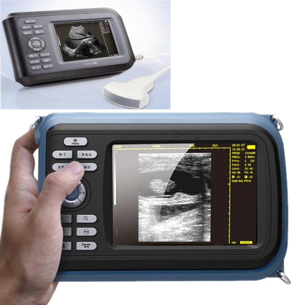 Portable Medical Ultrasound Scanner System Convex Probe Abdominal Free Oximeter DIAGNOSTIC ULTRASOUND MACHINES FOR SALE