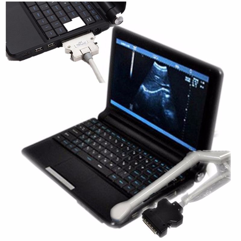 Portable Laptop Ultrasound Scanner +6.5 M Transvaginal Probe+3D+Case Fast Ship DIAGNOSTIC ULTRASOUND MACHINES FOR SALE