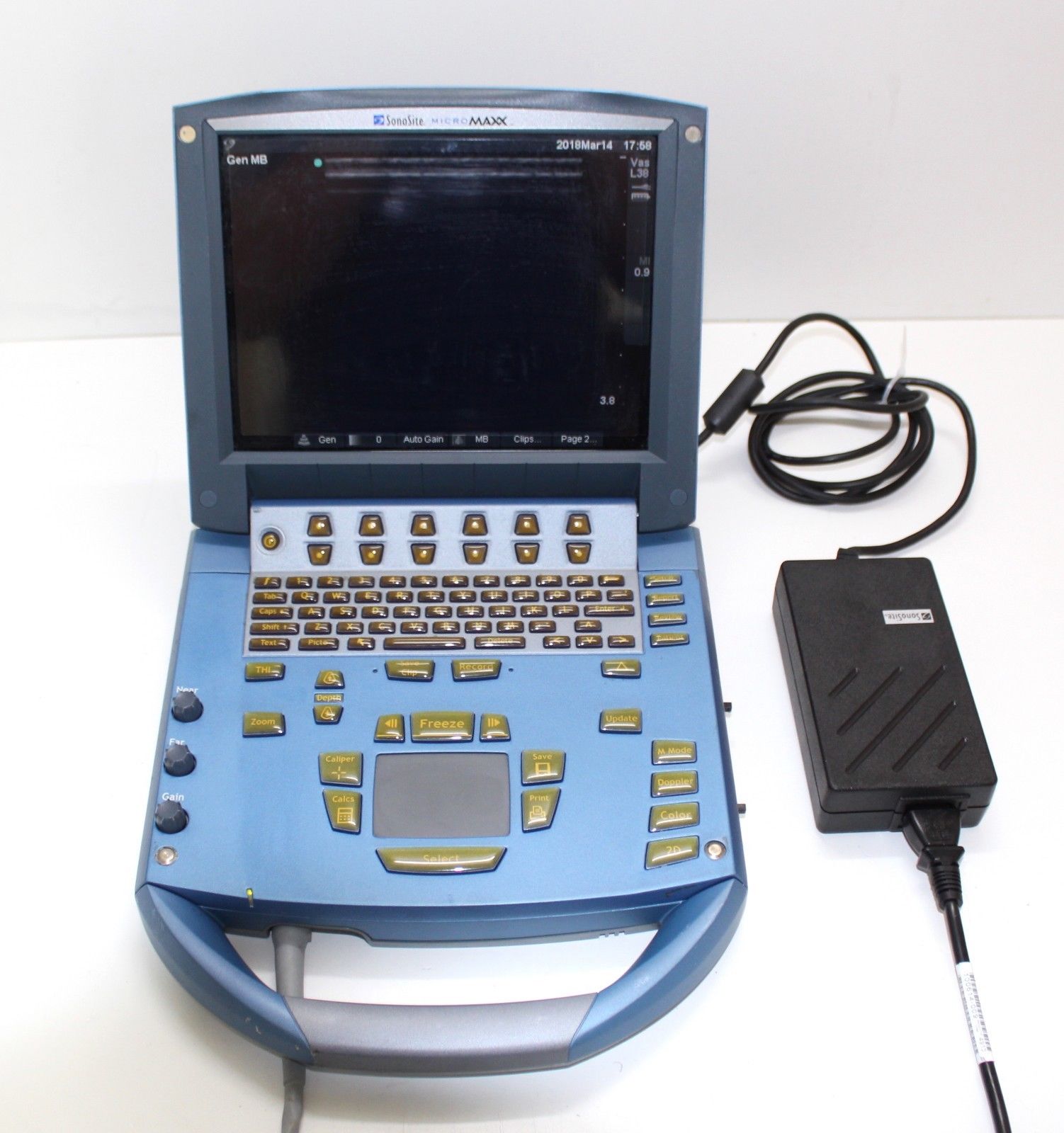 Sonosite Micromaxx Ultrasound ( please read) DIAGNOSTIC ULTRASOUND MACHINES FOR SALE