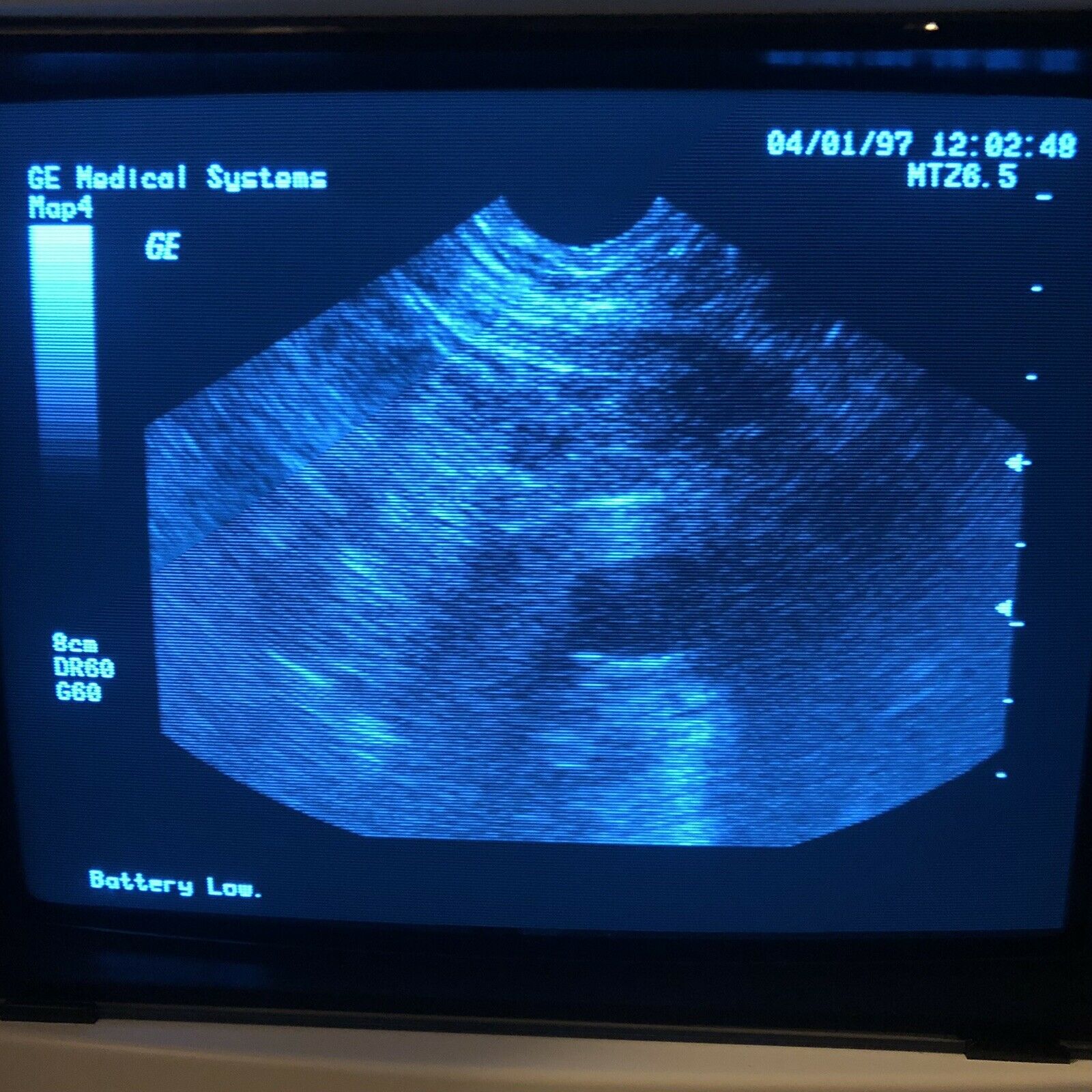 GE MTZ 6.5 MHz Endocavity Probe Ultrasound Transducer For Logiq 200 Series DIAGNOSTIC ULTRASOUND MACHINES FOR SALE