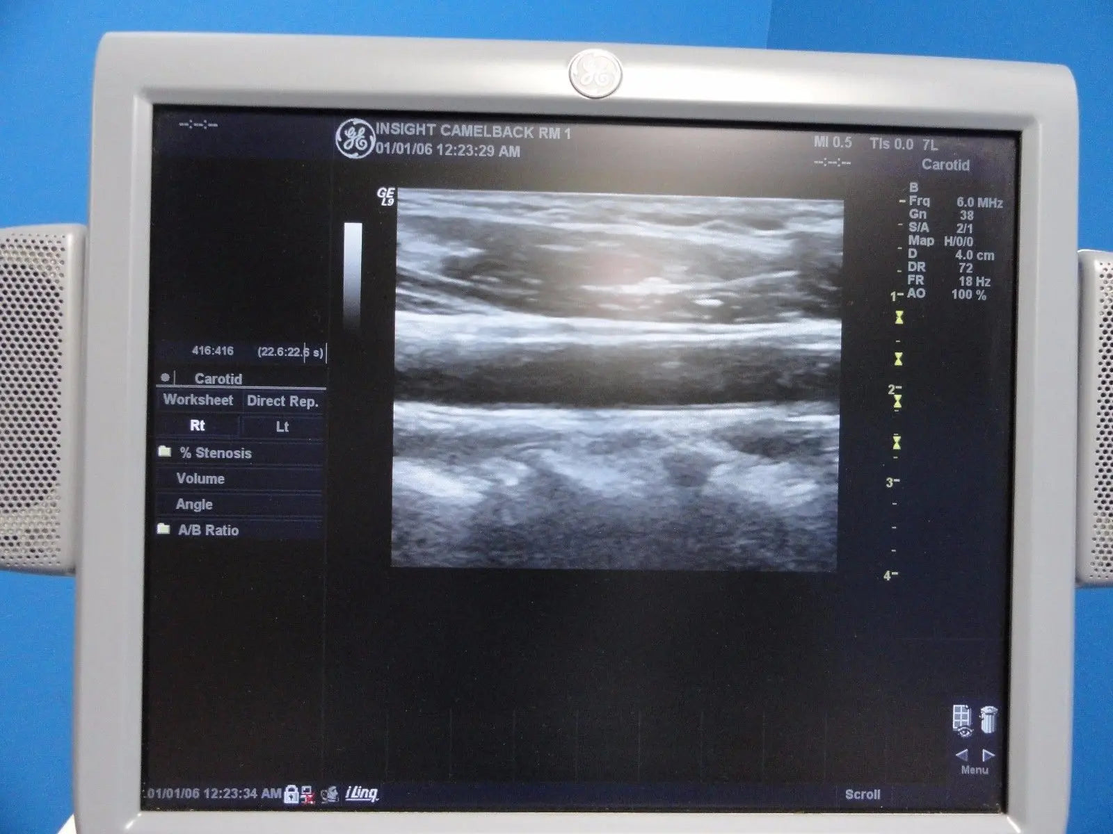 GE  7L / 2302648 Linear Array Ultrasound Probe for Logiq & Vivid Series~13787 DIAGNOSTIC ULTRASOUND MACHINES FOR SALE