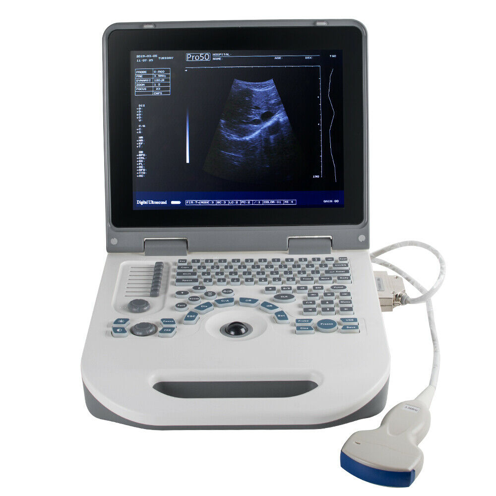 Portable Ultrasound Scanner Laptop Machine Safty Ultrasonic System+Convex Probe DIAGNOSTIC ULTRASOUND MACHINES FOR SALE