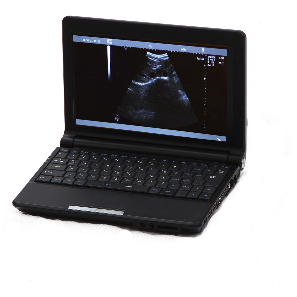 New Digital Portable Notebook Laptop Ultrasound Scanner+convex Sensor probe+3D 190891814036 DIAGNOSTIC ULTRASOUND MACHINES FOR SALE