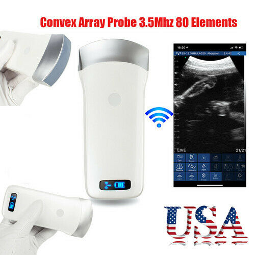 Portable WIFI Wireless Ultrasound Scanner Machine Convex Probe 3.5Mhz Medical CE DIAGNOSTIC ULTRASOUND MACHINES FOR SALE