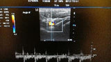 Mindray M5 Ultrasound w/cart