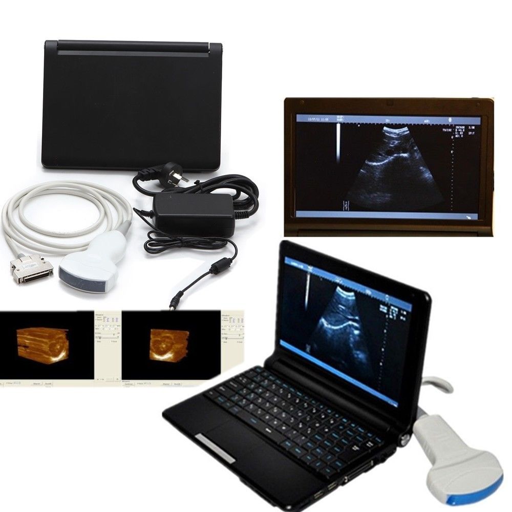 New +3D Software Laptop Ultrasound Machine Scanner system + Linear Probe 7.5MHZ DIAGNOSTIC ULTRASOUND MACHINES FOR SALE