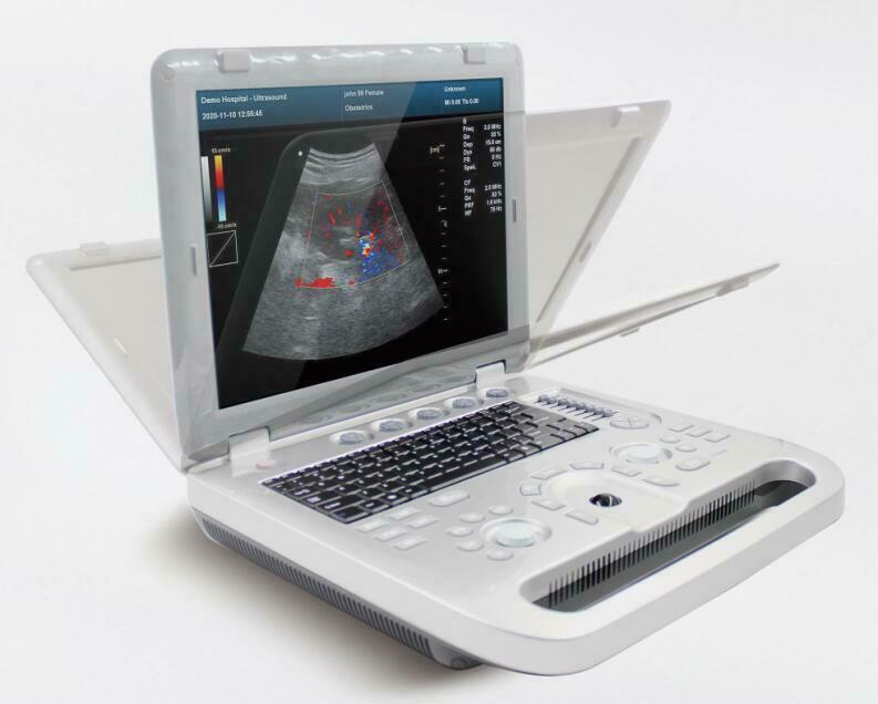 Color Doppler Ultrasound Scanner Cardiac Machine + Phased Array Probe Heart Exam DIAGNOSTIC ULTRASOUND MACHINES FOR SALE