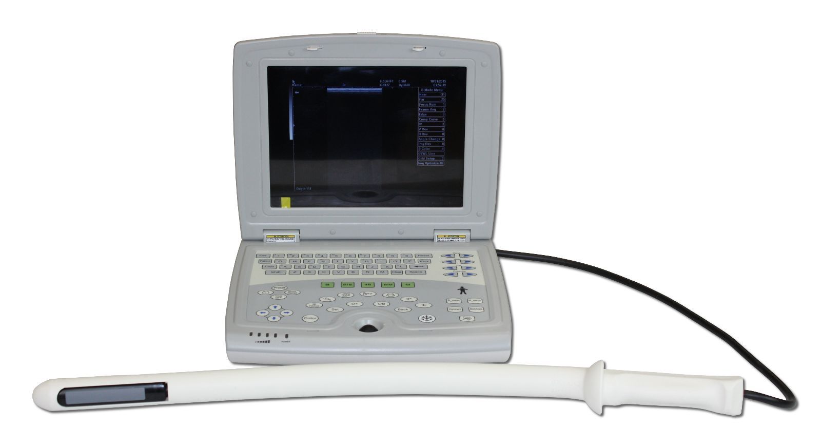 Veterinary Laptop - Animal Ultrasound Scanner - Bovine, Equine KeeboMed KX5000KV DIAGNOSTIC ULTRASOUND MACHINES FOR SALE