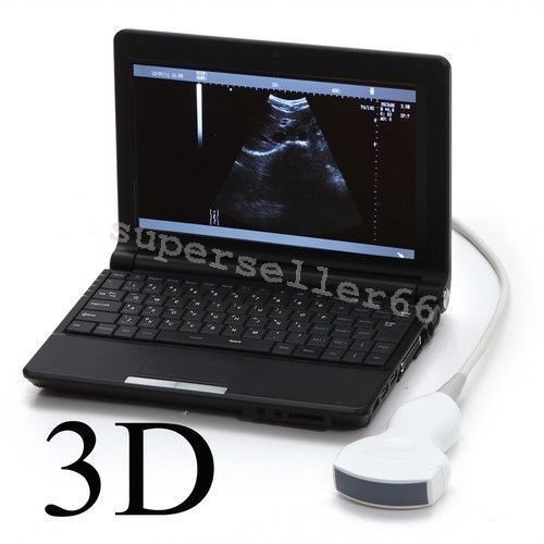 Digital LCD Monitor Ultrasound Scanner+Convex Linear Probe+Sony UP-897MD Printer DIAGNOSTIC ULTRASOUND MACHINES FOR SALE