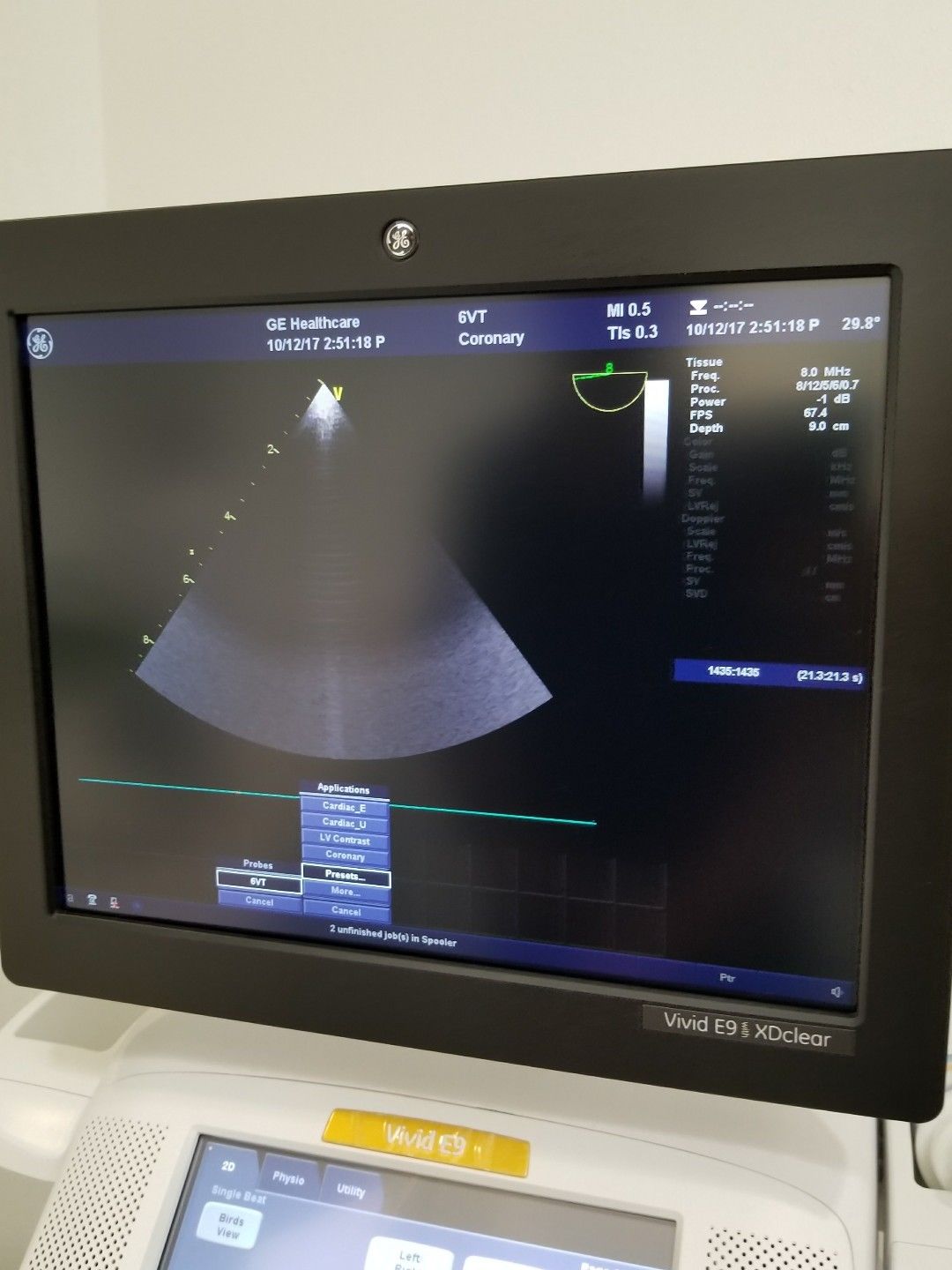 GE 6VT-D Ultrasound Probe / Transducer Demo Condition DIAGNOSTIC ULTRASOUND MACHINES FOR SALE