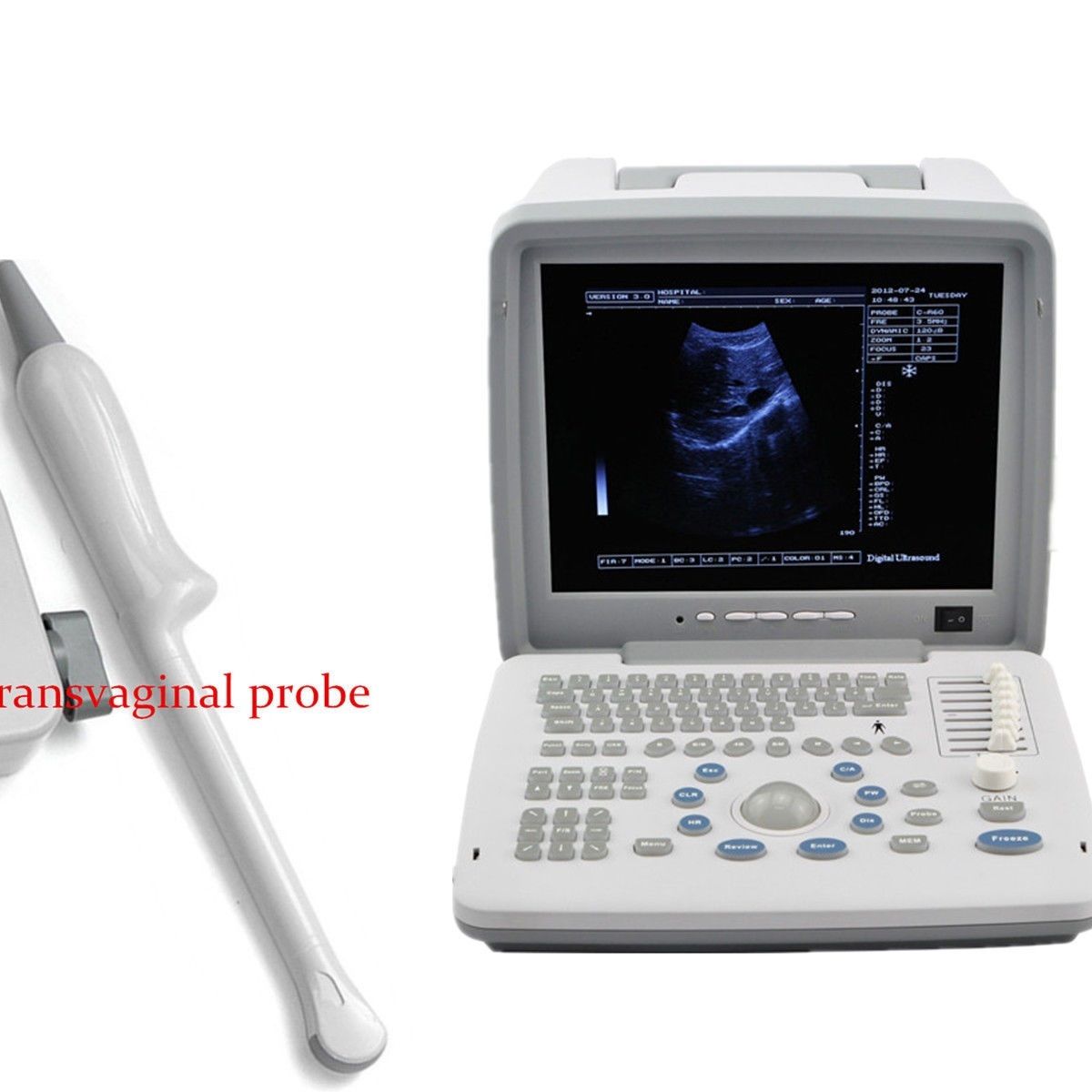Full Digital Laptop Portable Ultrasound Scanner+Transvaginal Probe  external 3D DIAGNOSTIC ULTRASOUND MACHINES FOR SALE