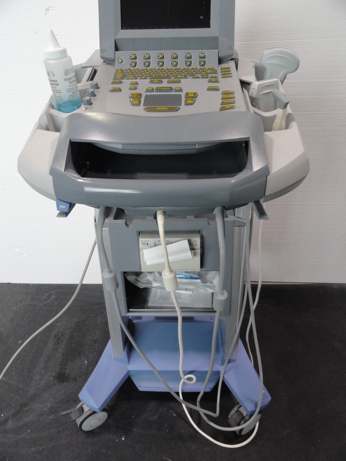 Sonosite Titan Portable Ultrasound Loaded unit with 3 probes transducers DIAGNOSTIC ULTRASOUND MACHINES FOR SALE