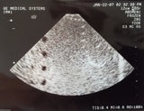 GE 3Sr Sector Cardiac Ultrasound Transducer Probe-Fully Tested For GE Logiq 700
