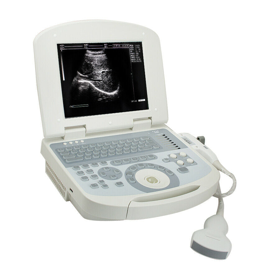 Portable Laptop Ultrasound Scanner 3.5MHz Convex Medical Ultrasound Machine +3D DIAGNOSTIC ULTRASOUND MACHINES FOR SALE