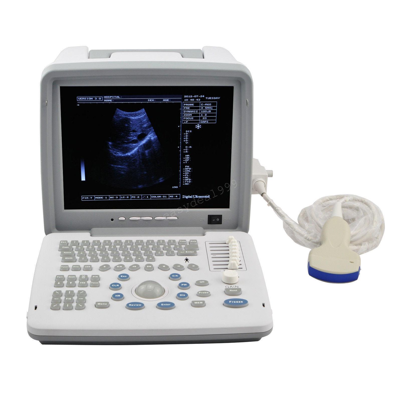 Digital Portable Ultrasound Scanner Machine Convex Linear Transvaginal 3 Probes* DIAGNOSTIC ULTRASOUND MACHINES FOR SALE