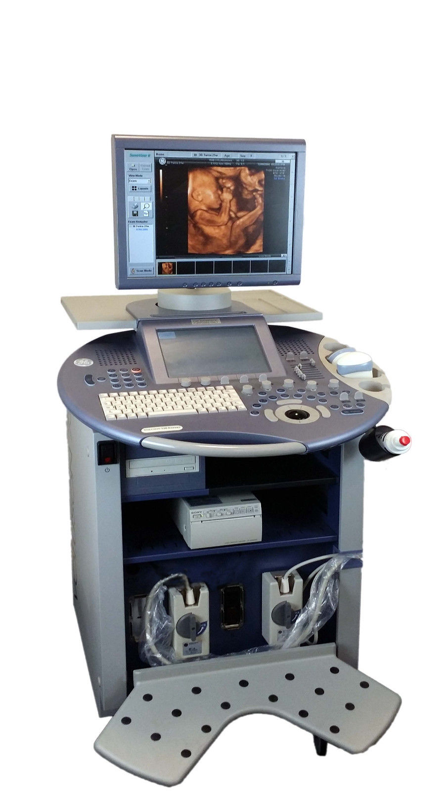 a ultrasound computer monitor sitting on top of a desk