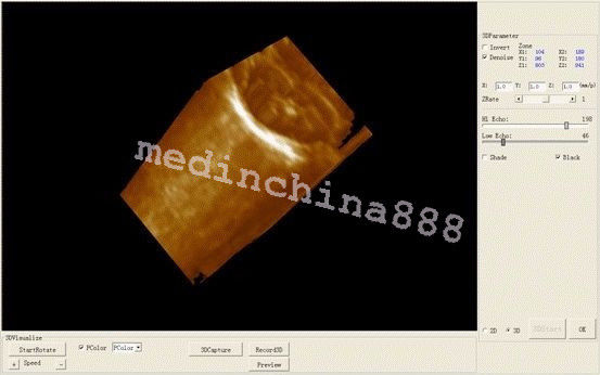 Man-Pack CCU ICU Ultrasound Scanner Convex + Linear 2 Probes Free 3D Best 190891255112 DIAGNOSTIC ULTRASOUND MACHINES FOR SALE