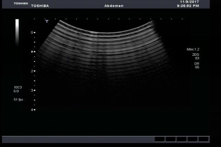 Toshiba PVT-674BT  Convex Ultrasound Transducer Probe DIAGNOSTIC ULTRASOUND MACHINES FOR SALE