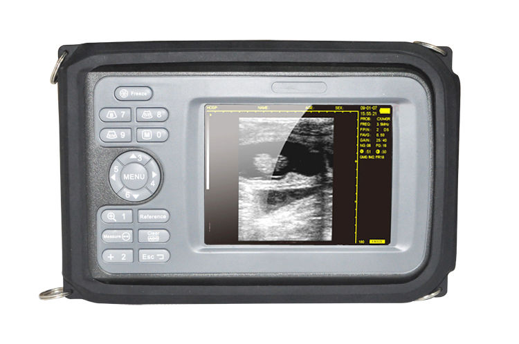 Veterinary Handheld TFT Ultrasound Scanner+Rectal Probe Ultrasound for Animal US DIAGNOSTIC ULTRASOUND MACHINES FOR SALE