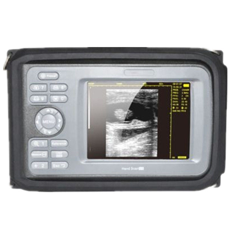 Vet 5.5'' Color Digital PalmSmart Ultrasound Scanner with Rectal Probe Medical DIAGNOSTIC ULTRASOUND MACHINES FOR SALE