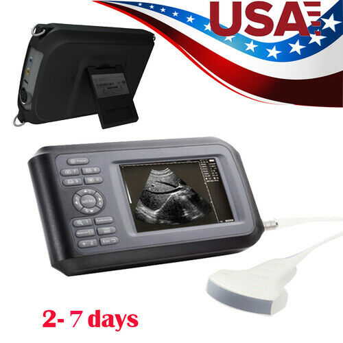 Handheld Digital Ultrasound Scanner Machine Ultrasonic Diagnostic Convex Probe DIAGNOSTIC ULTRASOUND MACHINES FOR SALE